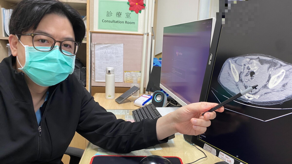 看似輕傷竟險死！工地男子金屬桿撞擊引內出血