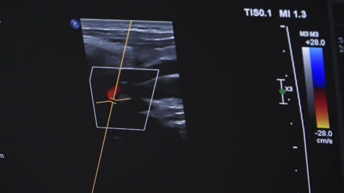 1ac65db44ae4565709fb2d61fbffc217