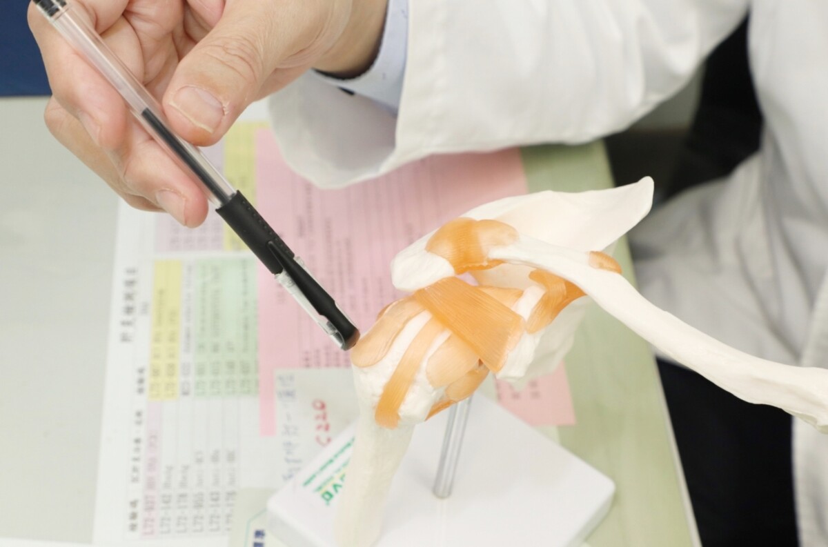 ▲旋轉肌破裂在關節鏡手術下使用雙排錨釘縫合，穩定度較好。(模型示意圖)。(圖/大里仁愛醫院提供)