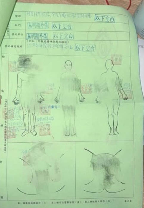 該起霸凌事件的驗傷單顯示並無明顯外傷,也讓整個事件陷入疑雲重重。(影像自網路爆料公社)。
