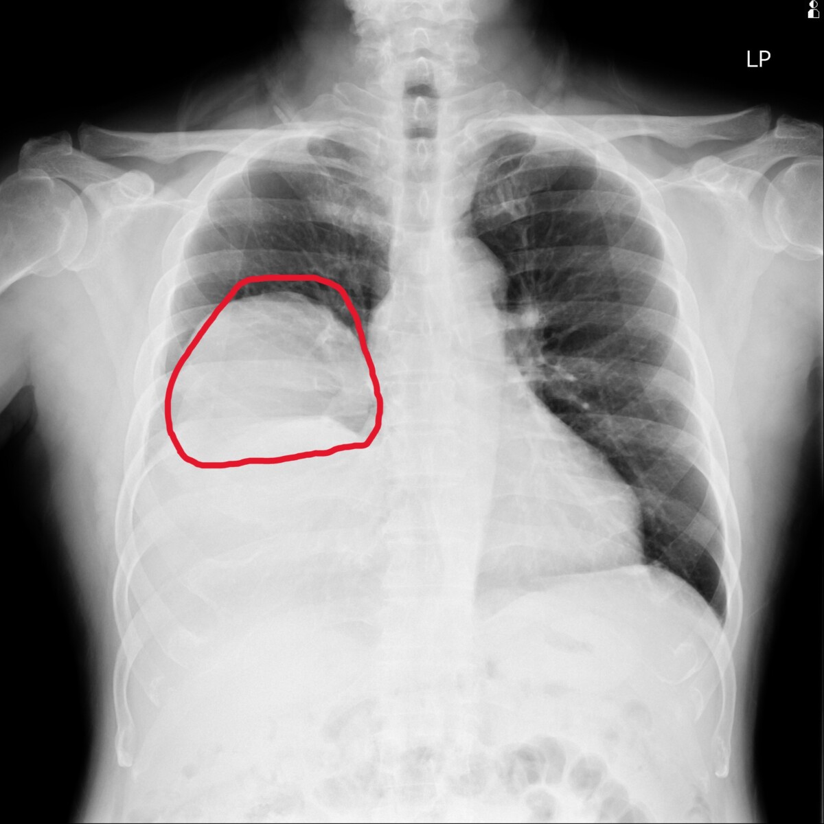 Fc892175a72de9156b395f5fe0acf1da